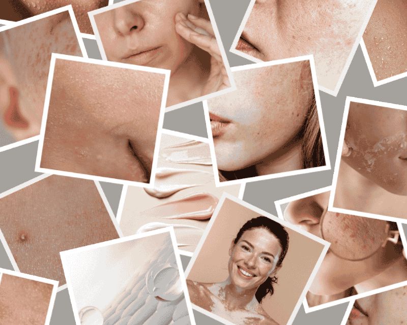 Skin preparation for prom makeup — foundation of a beautiful and lasting look