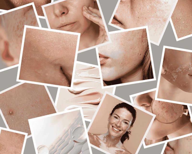 Skin preparation for prom makeup — foundation of a beautiful and lasting look